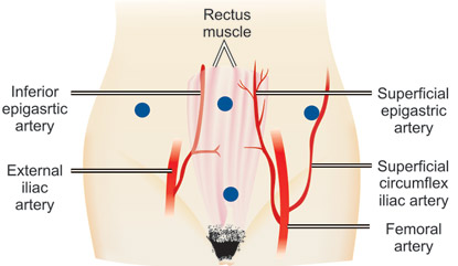 Fistula Repair Photo 1